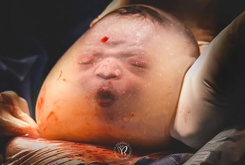 Best In Category: Birth Details: “Baby Noah Empelicado" is by Brazil's Jana Brasil of JanaBrasil Fotografia.
